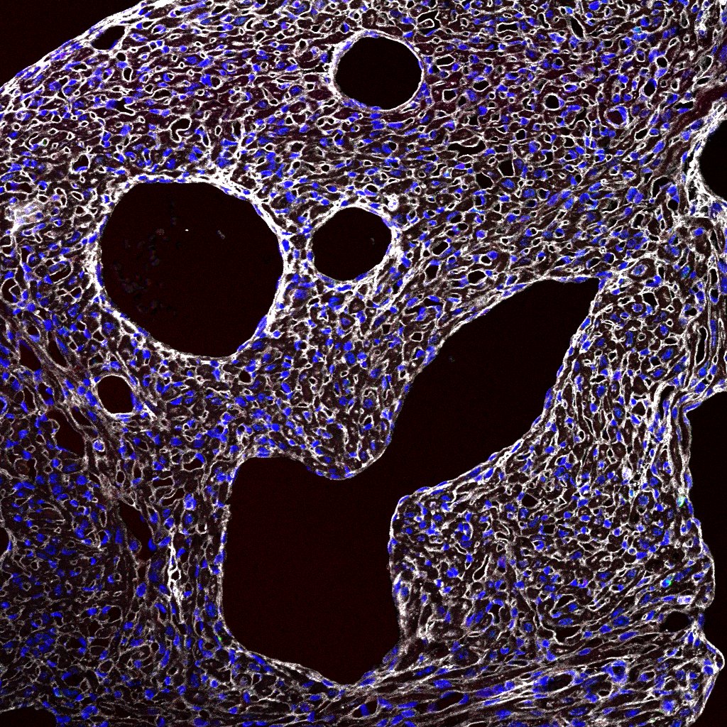 El grito. Cuando bajas a microscopía y no ha salido la inmuno